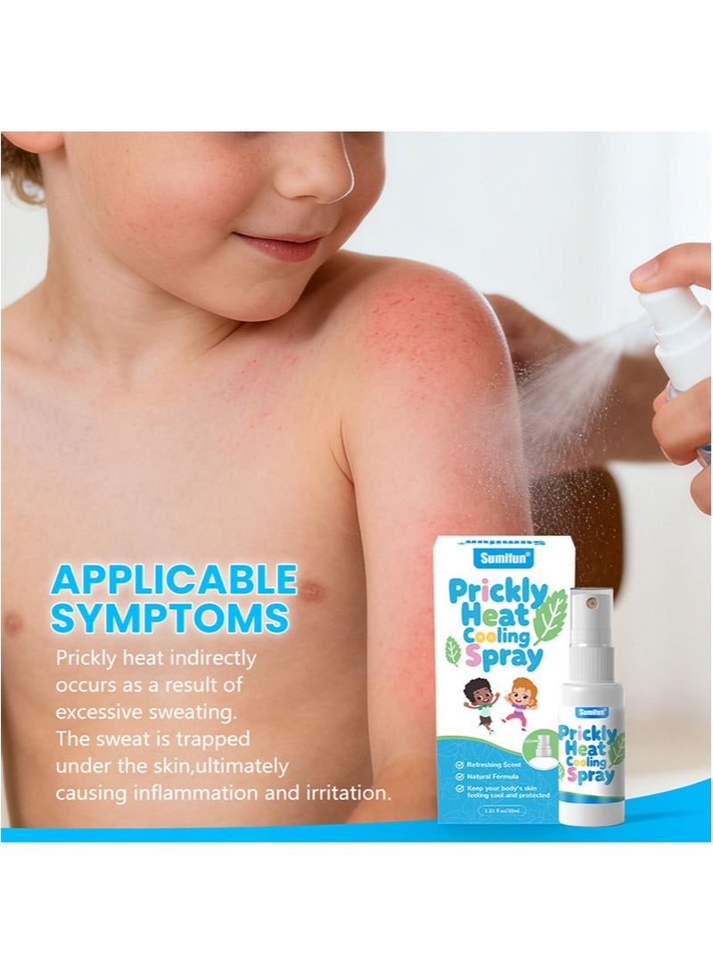 سوميفون عبوة من قطعتين من بخاخ تبريد الحرارة الشائكة يخفف الحرارة الشائكة وتهيج الجلد حماية مضادة للبكتيريا للبشرة يهدئ الحكة الناتجة عن لدغات الحشرات يوفر الراحة وتخفيف الحكة (30 مل + 30 مل) - Image 4